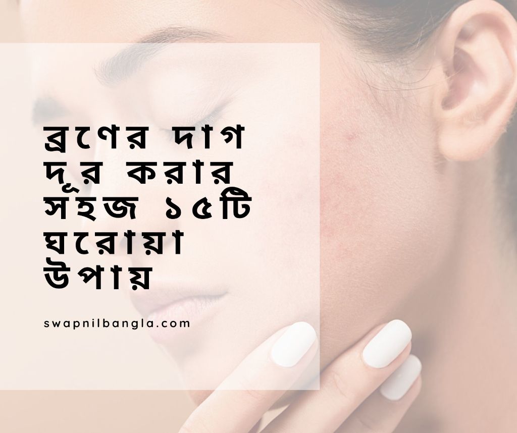 ব্রণের দাগ দূর করার ১৫টি ঘরোয়া উপায়