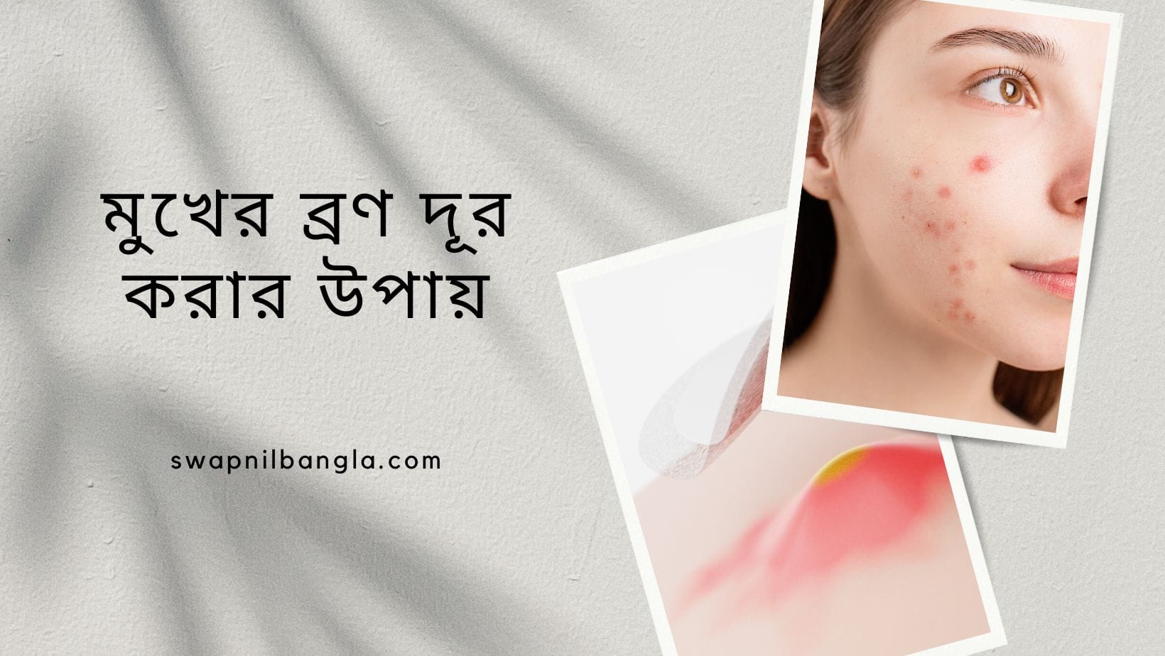 মুখের ব্রণ দূর করার উপায়