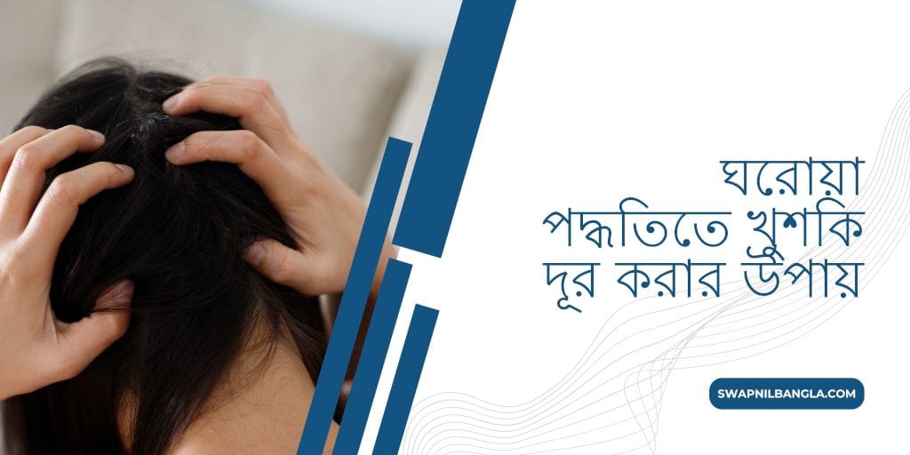 ঘরোয়া পদ্ধতিতে খুশকি দূর করার উপায়